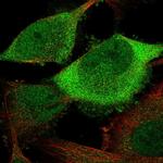 Cdc20 Polyclonal Antibody