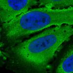 PDE4D Polyclonal Antibody