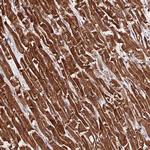 PDE4D Antibody in Immunohistochemistry (Paraffin) (IHC (P))