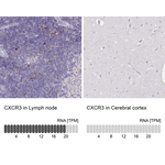 CXCR3 Antibody in Immunohistochemistry (Paraffin) (IHC (P))