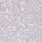 CXCR3 Antibody in Immunohistochemistry (Paraffin) (IHC (P))