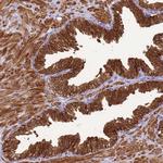 KLHL9 Polyclonal Antibody