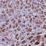 Bestrophin 2 Polyclonal Antibody