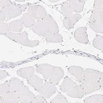 Carboxypeptidase B1 Antibody in Immunohistochemistry (Paraffin) (IHC (P))