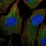 MEKK1 Polyclonal Antibody