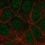 VEGF Receptor 3 Antibody in Immunocytochemistry (ICC/IF)