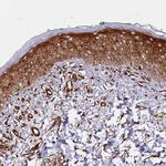 MRGPRE Polyclonal Antibody