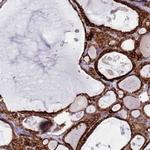 PDK3 Polyclonal Antibody