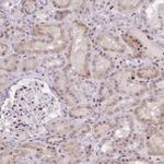 ERG Antibody in Immunohistochemistry (Paraffin) (IHC (P))