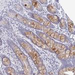 EBI3 Antibody in Immunohistochemistry (Paraffin) (IHC (P))
