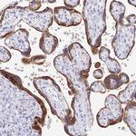 EBI3 Antibody in Immunohistochemistry (Paraffin) (IHC (P))