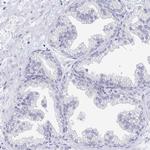 EBI3 Antibody in Immunohistochemistry (Paraffin) (IHC (P))