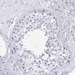 EBI3 Antibody in Immunohistochemistry (Paraffin) (IHC (P))