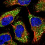 TREX1 Polyclonal Antibody