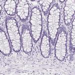 Aquaporin 2 Antibody in Immunohistochemistry (Paraffin) (IHC (P))