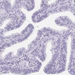 Aquaporin 2 Antibody in Immunohistochemistry (Paraffin) (IHC (P))