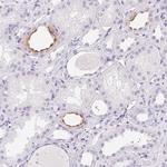 Aquaporin 2 Antibody in Immunohistochemistry (Paraffin) (IHC (P))