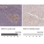 RGS14 Polyclonal Antibody