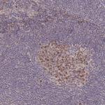 RGS14 Antibody in Immunohistochemistry (Paraffin) (IHC (P))