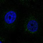 SCO2 Polyclonal Antibody