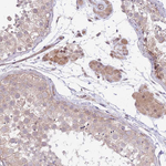 FUT3 Antibody in Immunohistochemistry (Paraffin) (IHC (P))