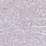 FUT3 Antibody in Immunohistochemistry (Paraffin) (IHC (P))