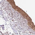 HIP Polyclonal Antibody