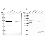 HIP Antibody in Western Blot (WB)