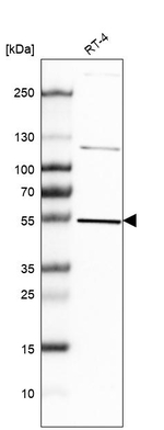 HIP Antibody in Western Blot (WB)