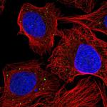 AEBP1 Polyclonal Antibody