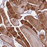 MEL18 Polyclonal Antibody