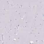p47phox Antibody in Immunohistochemistry (Paraffin) (IHC (P))