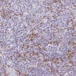 p47phox Antibody in Immunohistochemistry (Paraffin) (IHC (P))