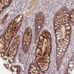 LEFTY Polyclonal Antibody