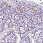 REG3A Polyclonal Antibody