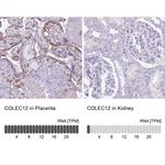 COLEC12 Polyclonal Antibody