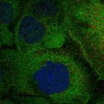 RANK Polyclonal Antibody
