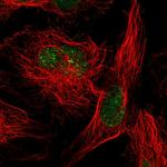 SUMO2 Polyclonal Antibody