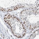 SUMO2 Antibody in Immunohistochemistry (Paraffin) (IHC (P))