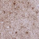 RanBP16 Polyclonal Antibody