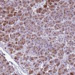Adenylate Cyclase 7 Antibody in Immunohistochemistry (Paraffin) (IHC (P))