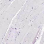 Lysozyme Antibody in Immunohistochemistry (Paraffin) (IHC (P))