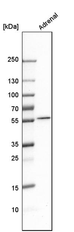 CYP17A1 Antibody in Western Blot (WB)