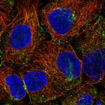 PHLPP2 Polyclonal Antibody