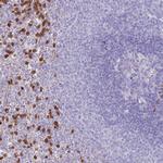 PHLPP2 Antibody in Immunohistochemistry (Paraffin) (IHC (P))