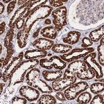 GSTM1 Antibody in Immunohistochemistry (Paraffin) (IHC (P))