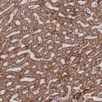 GSTM1 Antibody in Immunohistochemistry (Paraffin) (IHC (P))