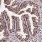 GSTM1 Antibody in Immunohistochemistry (Paraffin) (IHC (P))