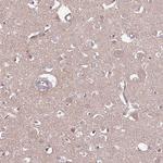 DPP10 Antibody in Immunohistochemistry (Paraffin) (IHC (P))