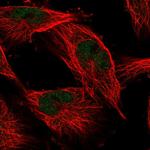 COMMD1 Polyclonal Antibody